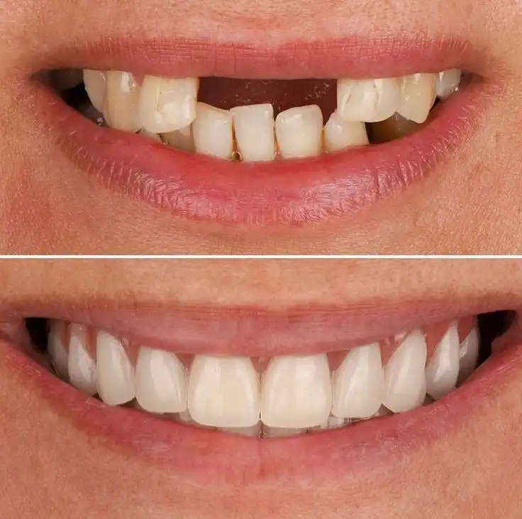Conservative Dentistry and Endodontics
