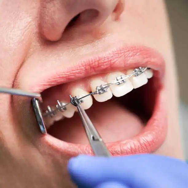 Orthodontics